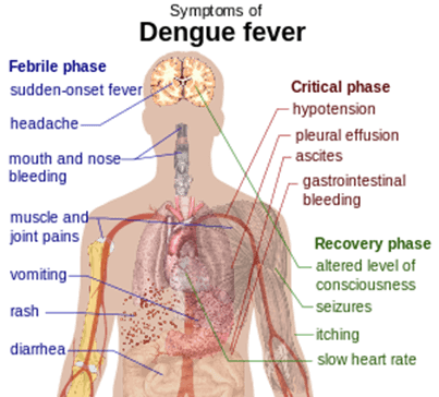 Virus del dengue Virus del dengue